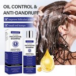 Anti-Dandruff Shampoo Manufacturer - Deep Cleaning for Folliculitis & Psoriasis