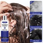 Antifungal Shampoo Manufacturer - Private Label for Scalp Psoriasis & Folliculitis