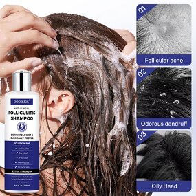 Antifungal Shampoo Manufacturer - Private Label for Scalp Psoriasis & Folliculitis