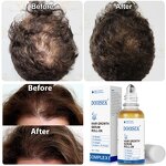 Hair Serum Manufacturer - OEM Wholesale 30ml Roll-on for Strengthening