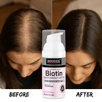 Hair Regrowth Gel Manufacturer - Own Brand Natural Herbal with Biotin