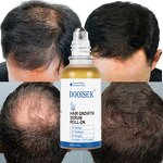 Hair Growth Serum Manufacturer - Natural Rosemary Roll on for Healthier Scalp