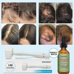 Derma Stamp Manufacturer - New Arrivals Adjustable 100 for Hair Regrowth