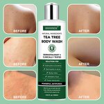 Scalp Care Shampoo Manufacturer - Spot Goods Herbal for Itchy & Dry Scalp