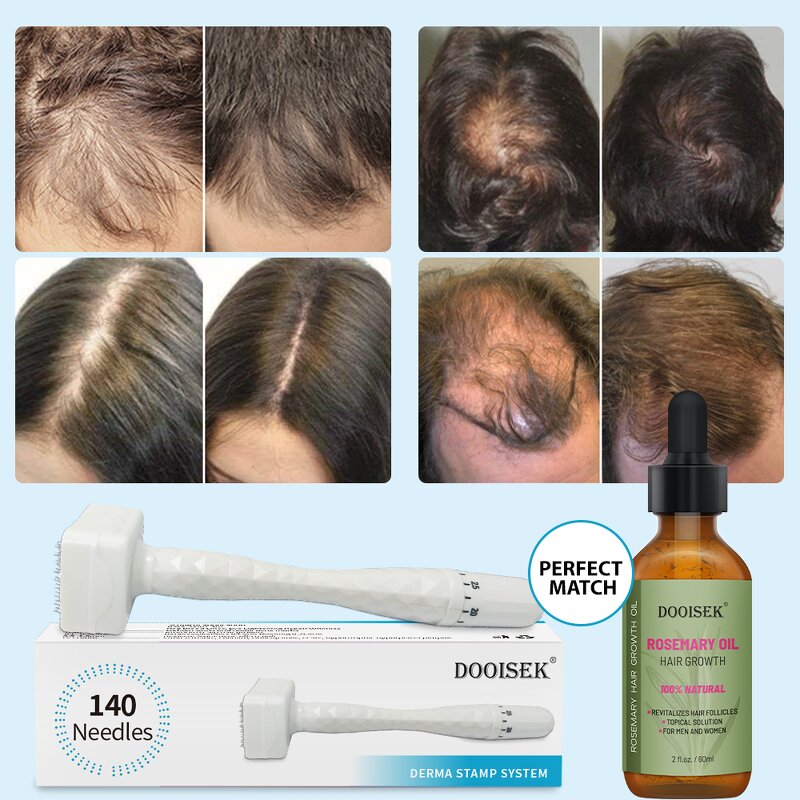 Derma Stamp Manufacturer - New Arrivals Adjustable 140 Microneedling