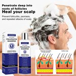 Anti Dandruff Shampoo Manufacturer - Direct Sales 250ml with Selenium Sulfide