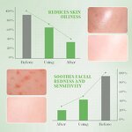 Amino Acid Cleansing Mousse - Factory - Salicylic Hyaluronic Acid Exfoliator Smoothing Calm Acne Redness Cleanser