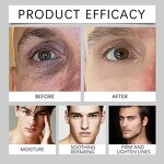 Eye Gel Pads - Manufacturer - Vegan Custom Hyaluronic Vitamin C Caffeine Whitening Anti-Puffiness Dark Circles