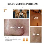 Beauty Soap - Factory - Private Label Vitamin C Kojic Glutathione Cruelty-free Whitening Anti Acne Soap