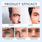 Men Eye Serum - Factory - Organic Kojic Coffee Infused Dark Circle Reduction Puffiness Brightening Face Care