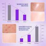 Bifida Cleansing Mousse - Manufacturer - Private Label Amino Hyaluronic Acid Cleanse Makeup Residue Soothe