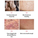 Charcoal Handmade Soap - Manufacturer - Wholesale Organic Aloe Kojic Acid 100g Moisturizing Nourishing Brightening