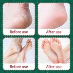 Foot Cream - Factory - Collagen Hyaluronic Acid Paraben-free Moisturizing Anti-aging Crack Treatment Repair