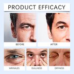 Men Eye Cream - Factory - Vitamin E Hyaluronic Acid Brightening Firming Reduce Dark Circles Eye Treatment