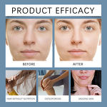 Protein Supplement Powder Manufacturer - OEM Super Hyaluronic Acid Anti Aging