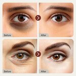 Retinol Eye Mask Manufacturer - Bio Collagen Anti Aging Reduce Wrinkles Puffy Bag & Private Label