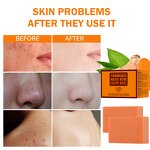 Turmeric Kojic Acid Soap Manufacturer - Handmade Anti-Acne Moisturizing Lightening Whitening
