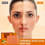 Turmeric Kojic Acid Soap Manufacturer - Handmade Anti-Acne Moisturizing Lightening Whitening