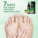 Nail Fungus Treatment Spray Manufacturer - 30ml 7 Days Solution Cuticle Care & Private Label