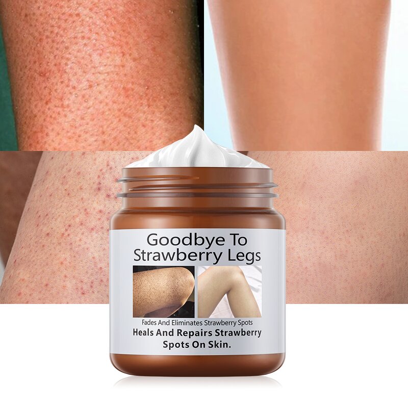 Beauty Leg Cream Manufacturer - Exfoliates Dead Skin Removes Pimples Smoothens Moisturizes