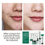 Skin Care Set Manufacturer - Tea Tree Salicylic Acid Anti-Pimple Cleanser Toner Essence