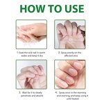 Nail Fungus Treatment Spray Manufacturer - 30ml 7 Days Solution Cuticle Care & Private Label