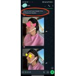 PDO Thread Manufacturer - Medical Mono Anti-wrinkle Face Eyebrow Lifting 60mm G