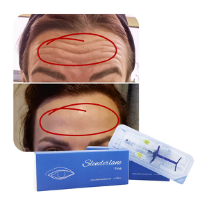 Dermal Filler Manufacturer - SLENDERLANE Cross Linked HA Lip Face Derm 1/1.1/10ml