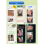 Dermal Filler Manufacturer - SLENDERLANE 1ml Medical Facial Injection & Private Label