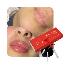 Dermal Filler Manufacturer - SLENDERLANE 1ml Medical Facial Injection & Private Label