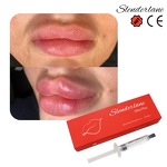 Dermal Filler Manufacturer - SLENDERLANE Korea HA Lip Derm 1/10ml Enlargement