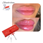 Dermal Filler Manufacturer - Cross Linked HA Gel Wrinkles Lip 1/2/10ml Derm Deep