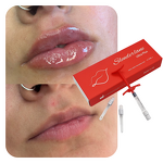 Skin Booster Gel Manufacturer - Non Cross Linked HA PDRN Mesotherapy Anti-Aging Wrinkle