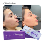 Dermal Filler Manufacturer - OEM Cross Linked HA Deep Nose Enlargement Wrinkle Remove
