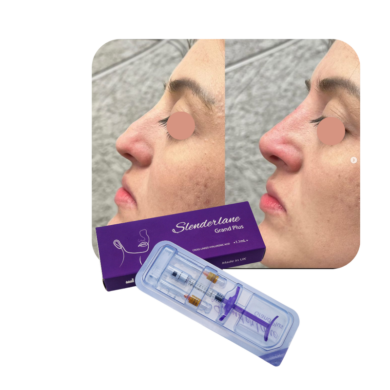 Dermal Filler Manufacturer - HA Rhinoplasty Facial Shaping Chin Nose Augmentation