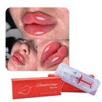 Dermal Filler Manufacturer - Cross Linked HA Gel Wrinkles Lip 1/2/10ml Derm Deep