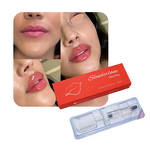 Dermal Filler Manufacturer - HA Facial Forehead Lips Anti-wrinkle 10/50ml & Private Label