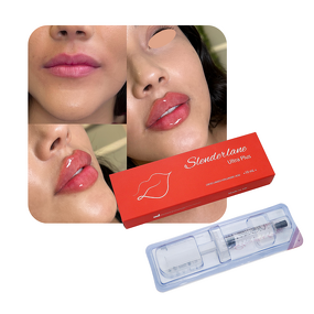 Dermal Filler Manufacturer - HA Facial Forehead Lips Anti-wrinkle 10/50ml & Private Label