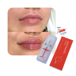 Dermal Filler Manufacturer - SLENDERLANE 1ml Medical Facial Injection & Private Label
