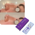 Dermal Filler Manufacturer - High Efficient Cross Linked HA Cheek Anti Aging Injections