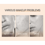 Face Cream Manufacturer - 50ml Acne Scar Stretch Mark Removal Camellia Glycerin Kojic Acid