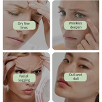 Facial Serum Manufacturer - Niacinamide VC Brightening Anti-sugar Anti-oxidation Dull Skin