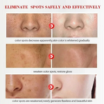 Freckle Cream Manufacturer - Whitening Fade Dark Spot Acne Mark Shrink Pores Pigmentation