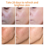 Freckle Cream Manufacturer - Whitening Fade Dark Spot Acne Mark Shrink Pores Pigmentation