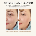 Anti-Acne Cream Manufacturer - Premium Moisturizing Calming Repair Problem Skin Relief Lotion