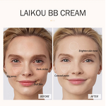 Face Cream Manufacturer - 50ml Acne Scar Stretch Mark Removal Camellia Glycerin Kojic Acid