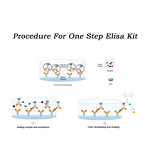 ELISA Kit Manufacturer - Mouse Interleukin 4 IL4 One Step Immune Factor Detection