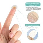 Acne Patches Manufacturer - Hydrocolloid for Early Stage Treatment & Custom Pimple Patch