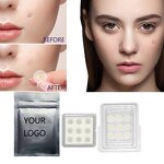 Acne Patches Manufacturer - Hydrocolloid for Early Stage Treatment & Custom Pimple Patch