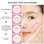 Pimple Patches Manufacturer - Private Label Cute Cartoon Hydrocolloid 36-Piece for Acne